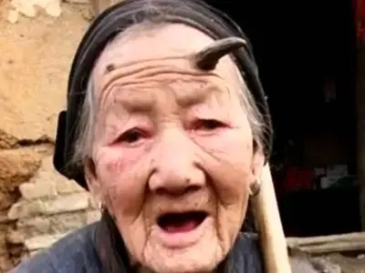 چرا برخی انسان‌ ها شاخ درمی‌ آورند؟ رازهای عجیب و شگفت‌ انگیز!