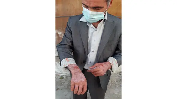 آخرین خبر از پرونده مرد کتک خورده در دفتر پیشخوان دولت/ او به یک زن تذکر حجاب داد !+ عکس