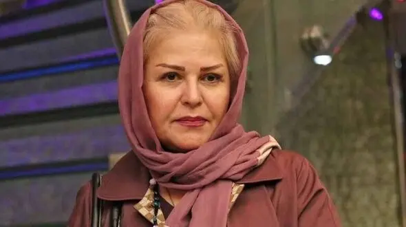 اکرم محمدی از ریخت و قیافه افتاد ! / تزریق زیبایی چهره خانم بازیگر را نابود کرد !