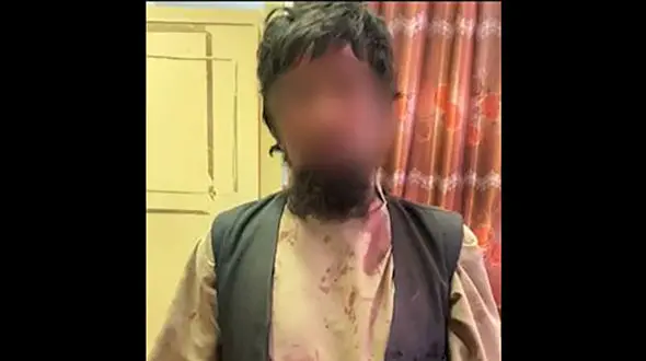 این مرد دامادش راسلاخی کرد +عکس