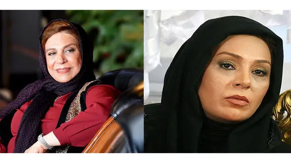 تلخ ترین عکس از نسرین مقانلو / این چهره خانم بازیگر دلتان را آب می کند !