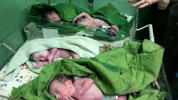 برای اولین بار در گلستان یک بانوی آق قلایی چهارقلو زایید+عکس