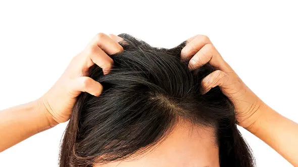 اگر پوست سرتان می خارد این مطلب را بخوانید 