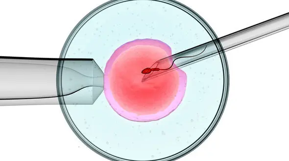 iui چیست؟ + جزئیات شانس بارداری 