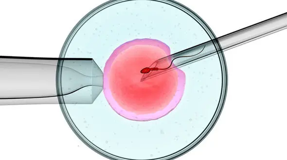 iui چیست؟ + جزئیات شانس بارداری 