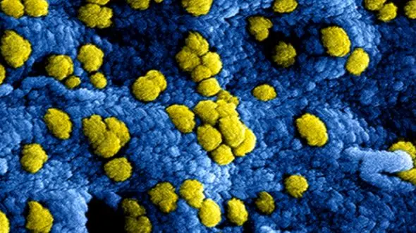 انجام این 3 کار برای مقابله با کرونا کافیست