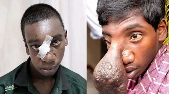 مغز این پسر از بینی اش بیرون زده بود! + عکس حیرت انگیز