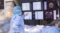 تجهیز بیمارستان پورسینای رشت به دستگاه آنژیوگرافی مغز 