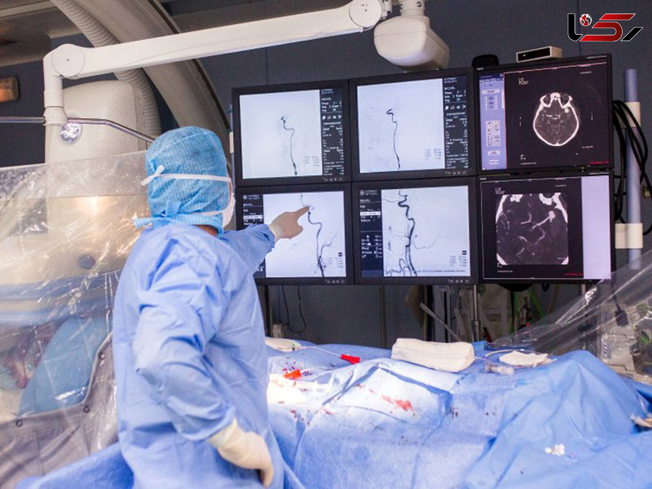 تجهیز بیمارستان پورسینای رشت به دستگاه آنژیوگرافی مغز 