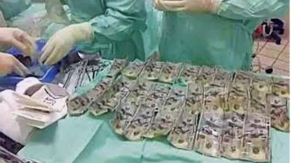 بلعیدن پس انداز خانوادگی برای انتقام از شوهر+عکس