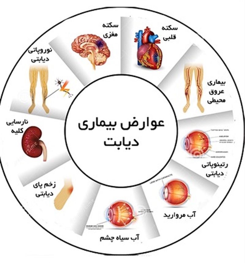 عوامل موثر بر بروز عوارض دیابت