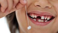 تعبیر خواب افتادن دندان چیست؟