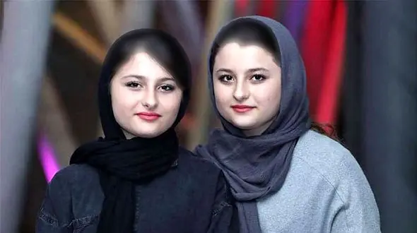 چهره نیکای سریال پایتخت در 20 سالگی / پر از ژل و تزریق ! 