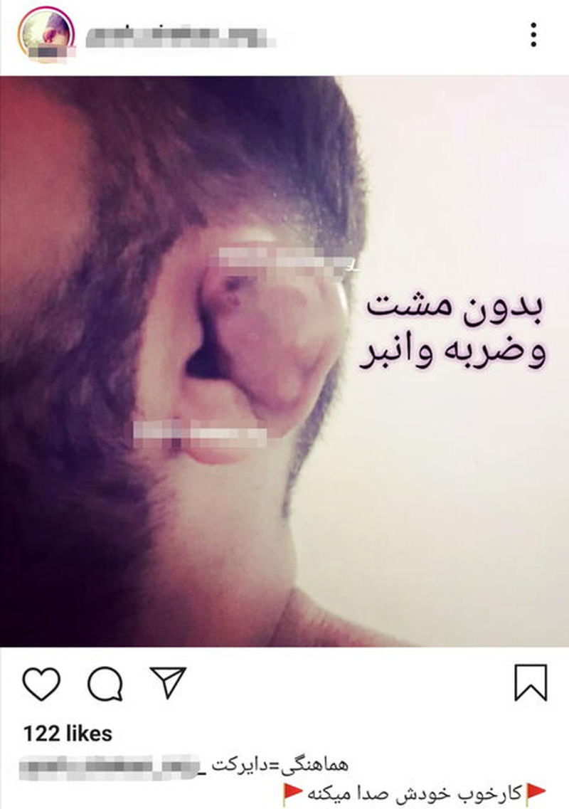 شکستن گوش