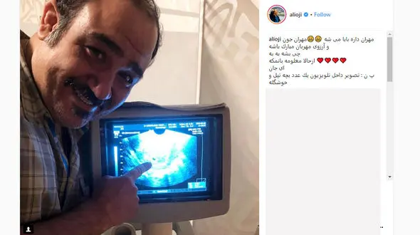 مهران غفوریان پدر می شود +عکس 