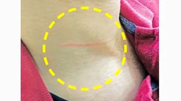 حمله دزدان خشن به یک خبرنگار در تهران