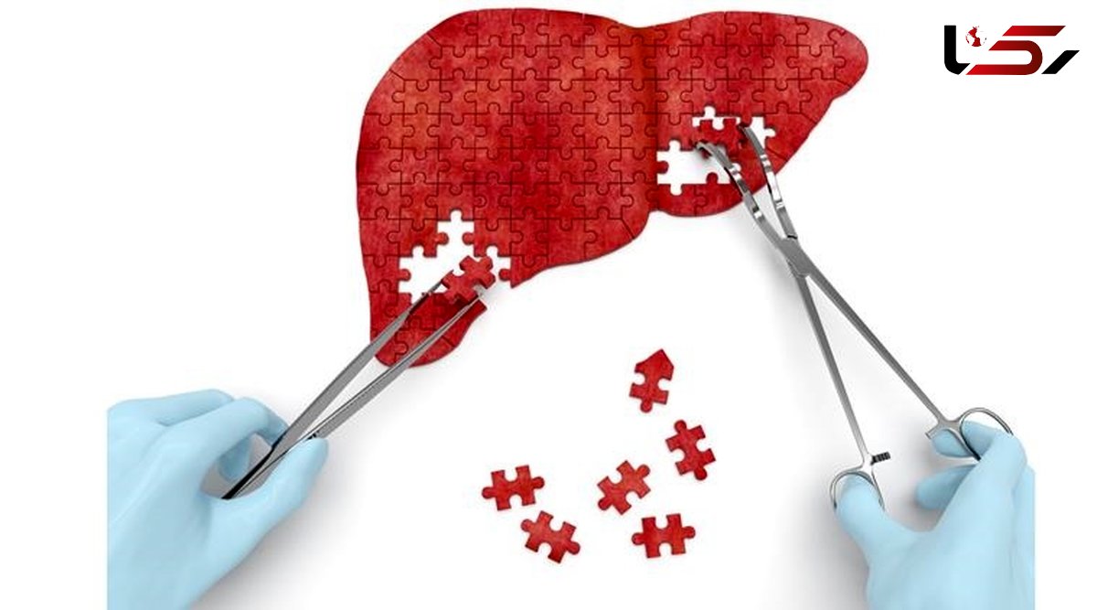 این نشانه های هشدار سرطان کبد است