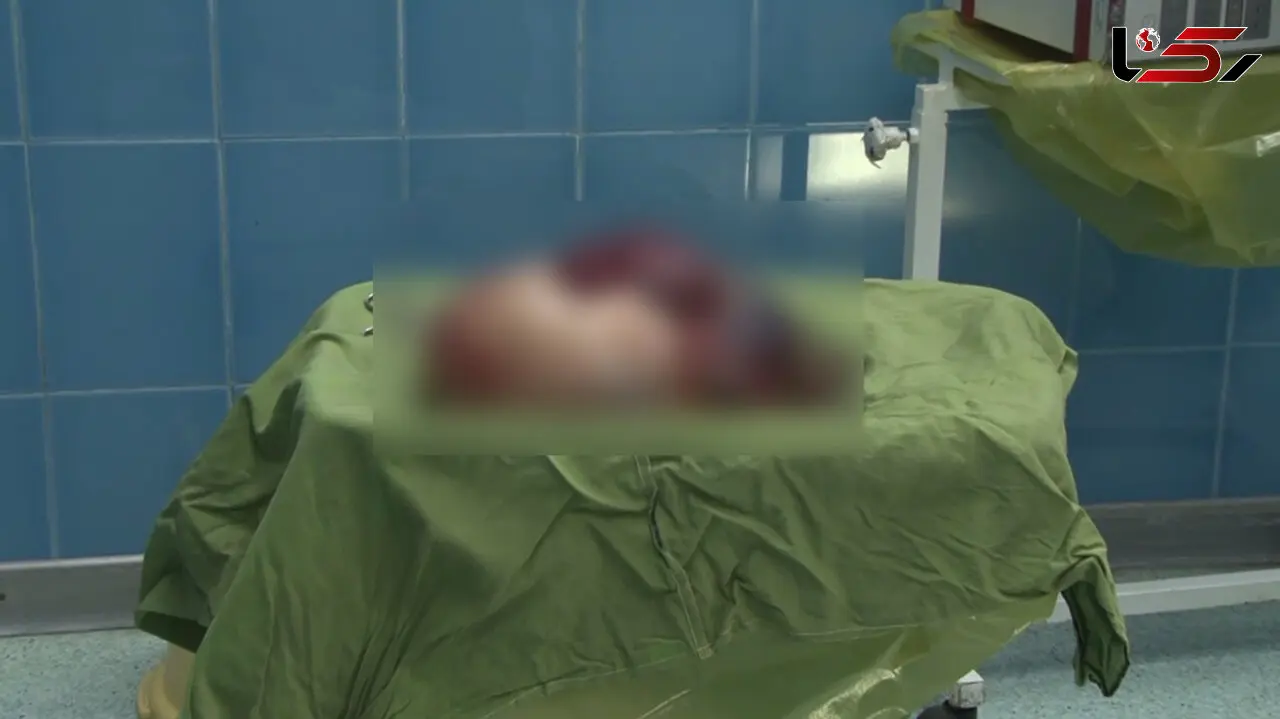 برآمدگی شکم زن 55 ساله همه را شوکه کرد / در بهشهر چه اتفاقی افتاد؟