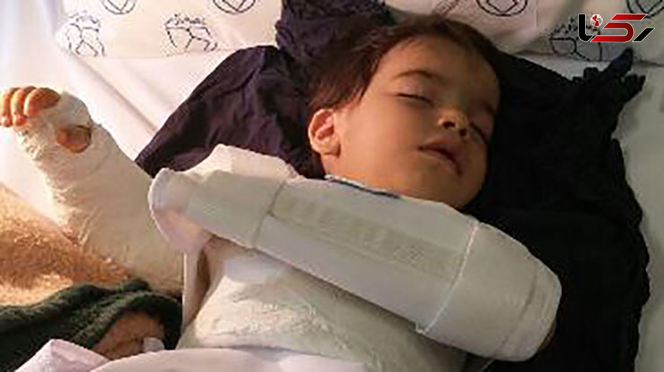  جراحی اشتباهی دست پسر بچه در بیمارستان اصفهان+عکس