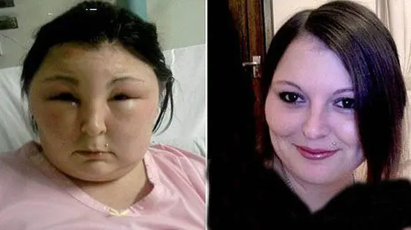 رنگ مو این زن زیبا را به هیولا تبدیل کرد + عکس های حیرت آور