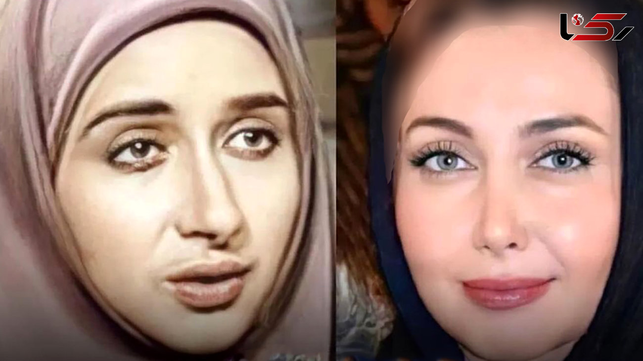 چهره قبل و بعد عمل بازیگران ایرانی ! + اسامی باورنکردنی با چهره های حیرت آور 