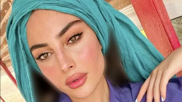  تغییر بزرگ ترلان پروانه  فقط در 2 هفته ! / از این رو به اون رو شد ! + عکس