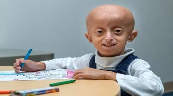 پیرترین دختربچه درگذشت  + عکس