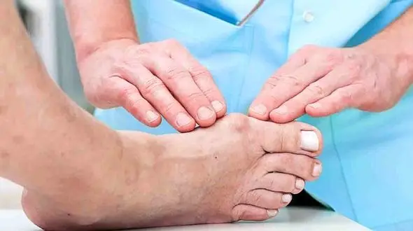 رایج‌ترین علائم بیماری نقرس چیست؟