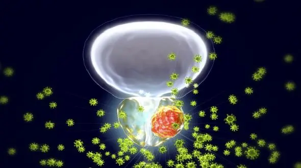 هوای آلوده، تهدیدی برای سلامت پروستات مردان