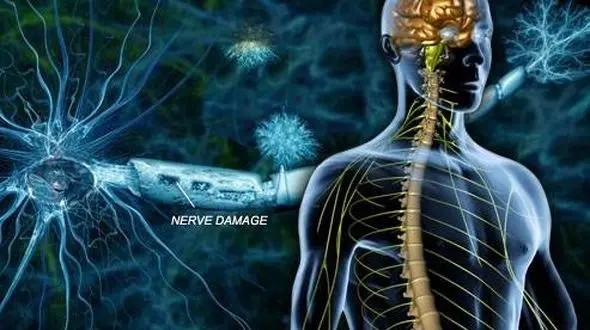 ام اس بیماری که زنان خوشگل را گرفتار می کند