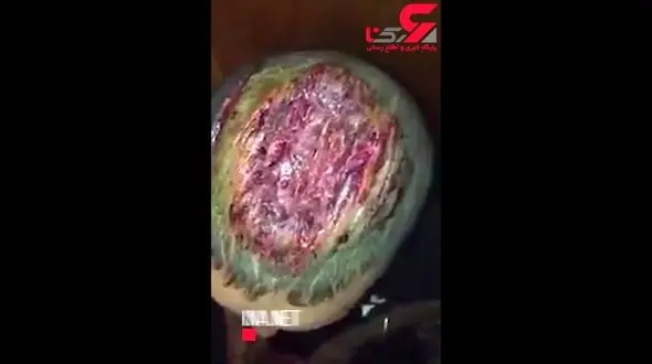 منزجر کننده ترین صحنه  از یک تصادف  خونین+ فیلم