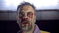 چهره خون آلود و زخمی بهرنگ علوی + عکس 