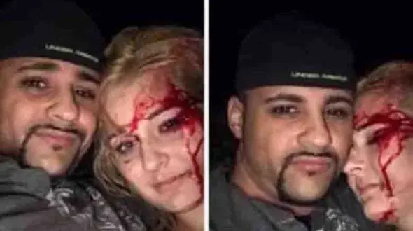 عکس سلفی پس از آزار وحشیانه دختر 22 ساله+ عکس 16+