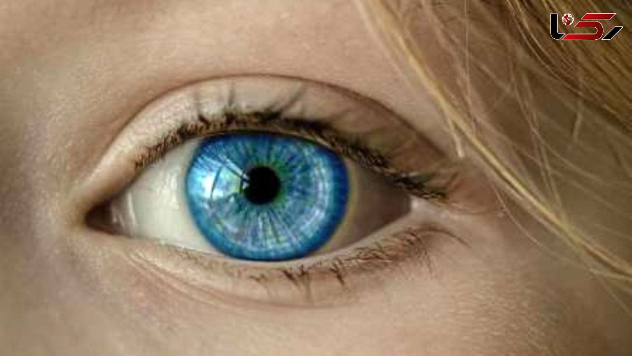درمان قرنیه متحول می‌شود / درمان سلول های آسیب دیده  چشم 
