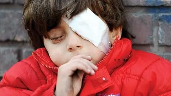 حکم کور شدن یک مرد به خاطر اقدام وقیحانه بایک دختر 4 ساله سنندجی اجرا شد+ عکس