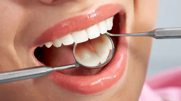 واکسن پوسیدگی دندان 