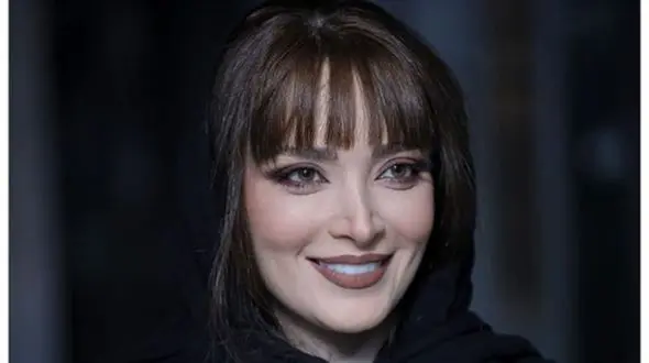 تغییر فاحش چهره بهنوش طباطبایی بعد  عمل زیبایی + عکس قدیمی و جدید خانم بازیگر