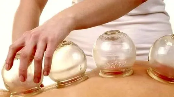 ترفندهایی برای اثربخشی حجامت