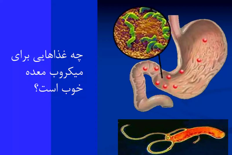 غذاهیا خوب برای میکروب معده