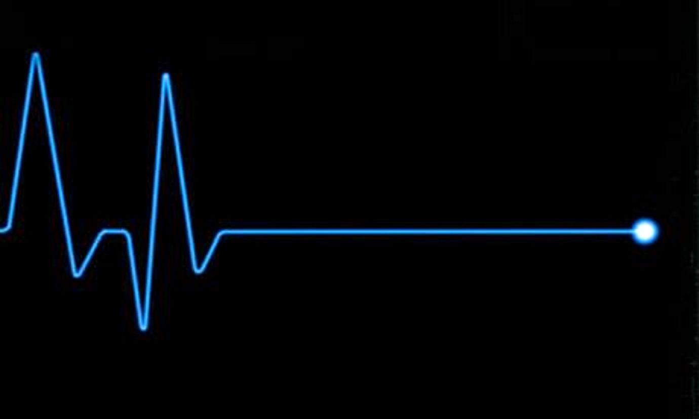 Сердцебиение остановилось. Кардиограмма остановки сердца. Пульс смерть. Пульс остановился. Прямая линия пульса.