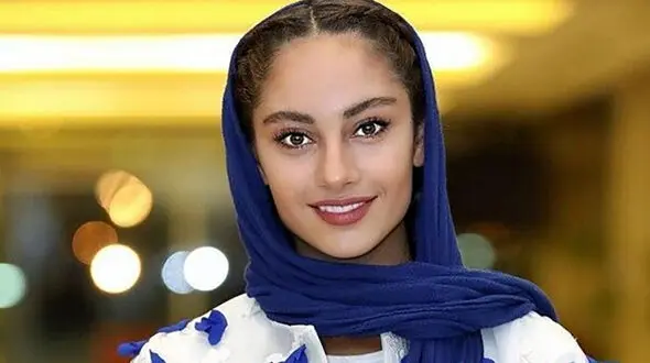 عکس غیرقابل تحمل ترلان پروانه قبل از عمل زیبایی / خانم بازیگر چقدر تغییر کرد !