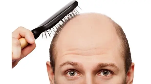 مواد غذایی ضد ریزش مو