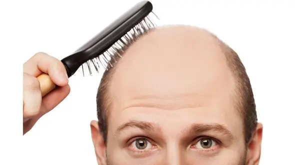 مواد غذایی ضد ریزش مو