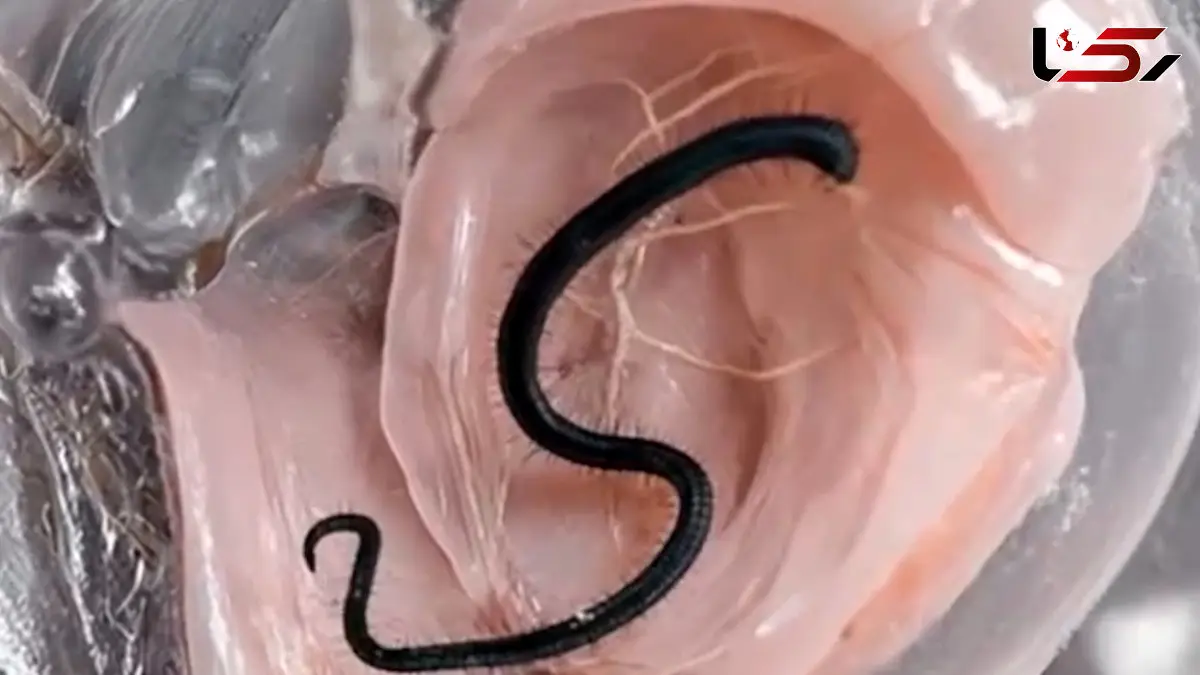 فیلم کنترل ذهن آخوندک توسط انگل کرم مویین