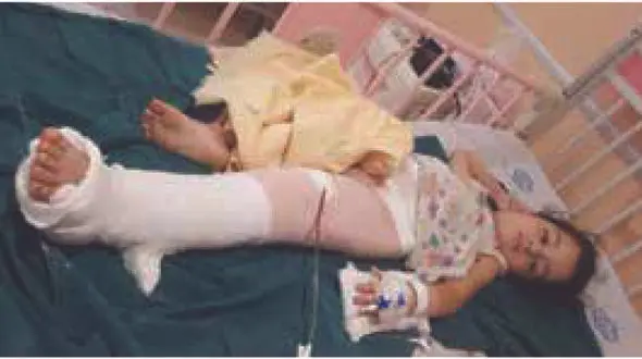نجات عجیب دختری که در خواب راه رفت / در قائمشهر رخ داد + عکس