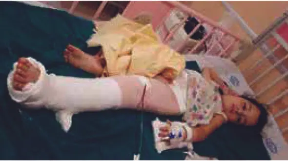 نجات عجیب دختری که در خواب راه رفت / در قائمشهر رخ داد + عکس