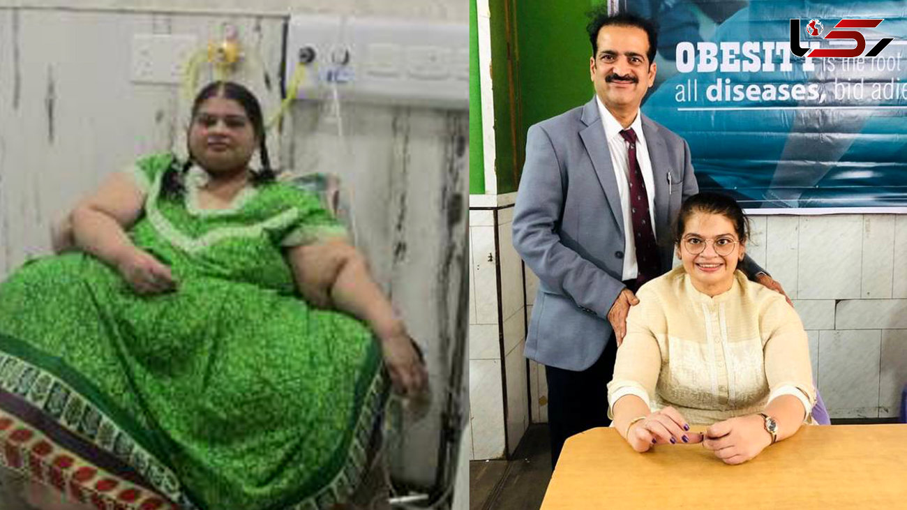 زن 42 ساله رکورد کاهش وزن را زد + عکس