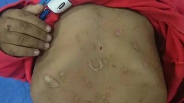نجات ستایش کوچولو از شکنجه گاه پدرومادر شیشه ای+تصویر