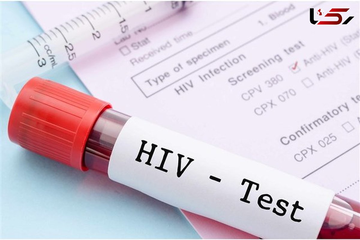 آخرین آمار مبتلایان به ایدز یا HIV در کشور