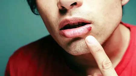 علت  چیست ؟ + فیلم 